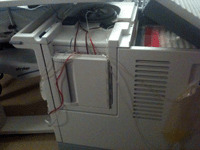 Photopheresis machine, Froedtert Hospital, Milwaukee Wisconsin